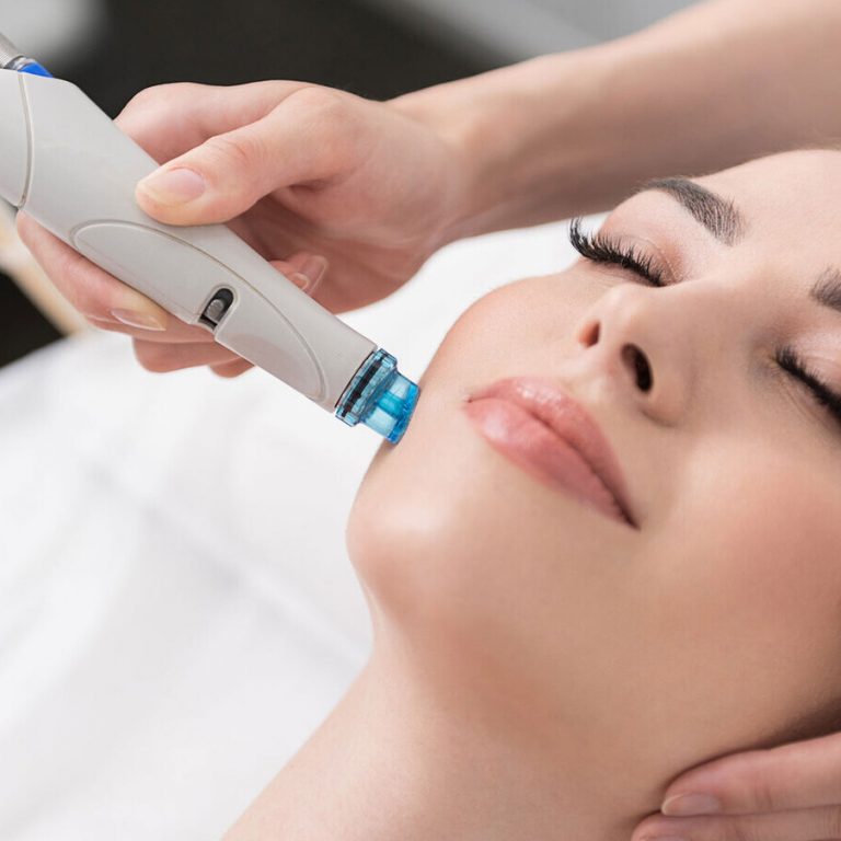 Aqua Peeling Services in Germany